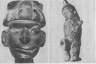 「Fig 31 Peruvian Huaco: Facial paralysis (left) & Skin disease (right). 図31 ペルーのワコ:顔面麻痺(左)、皮膚病(右)」のキャプション付きの図